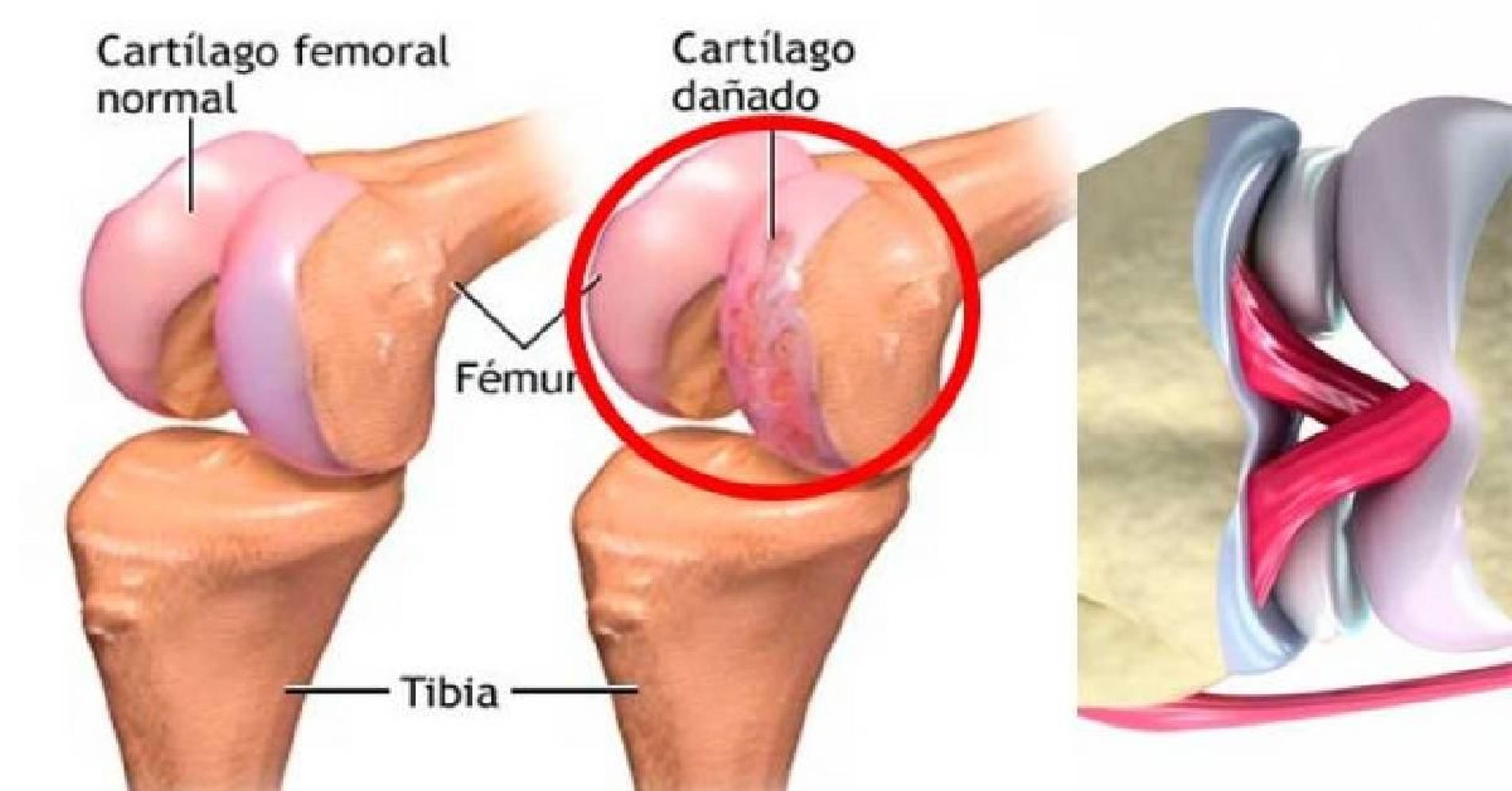 El cartílago