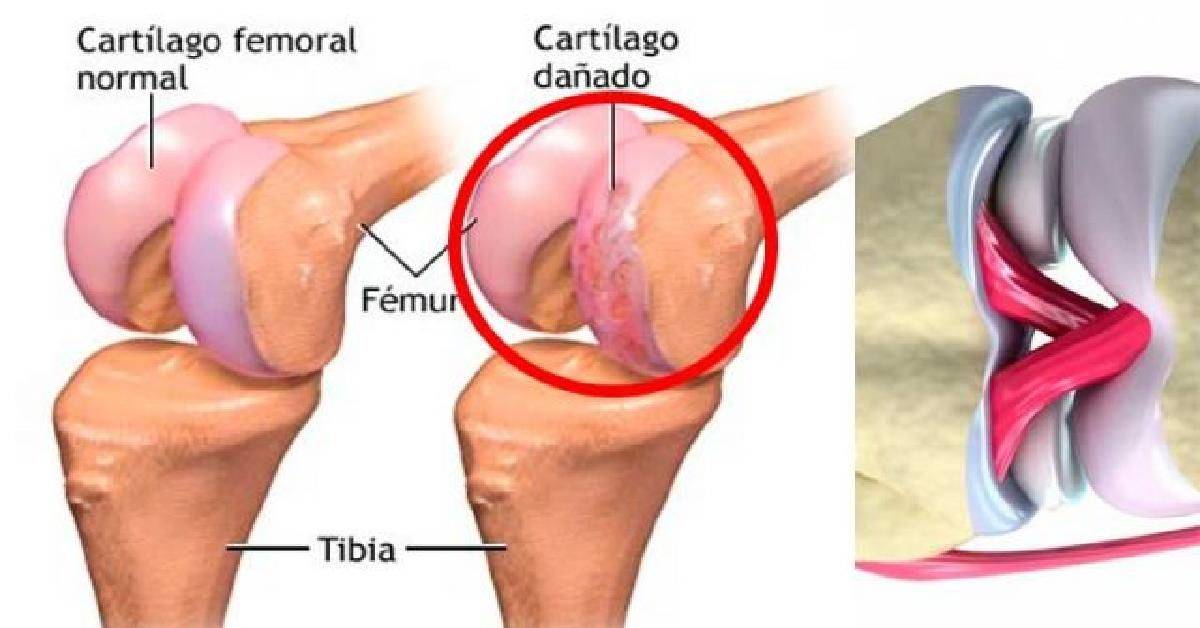 El cartílago
