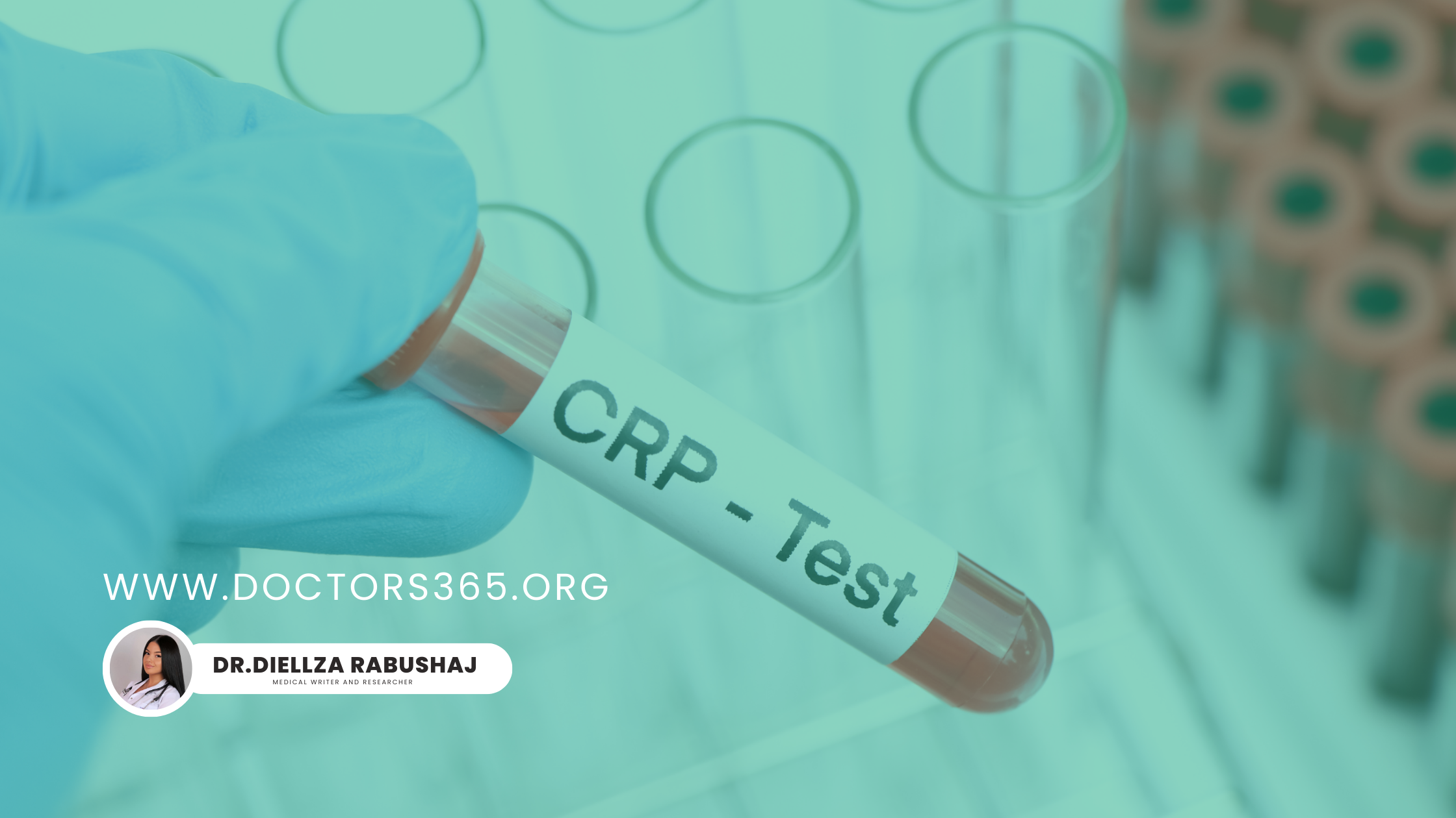 High hsCRP: What It Means for Your Heart