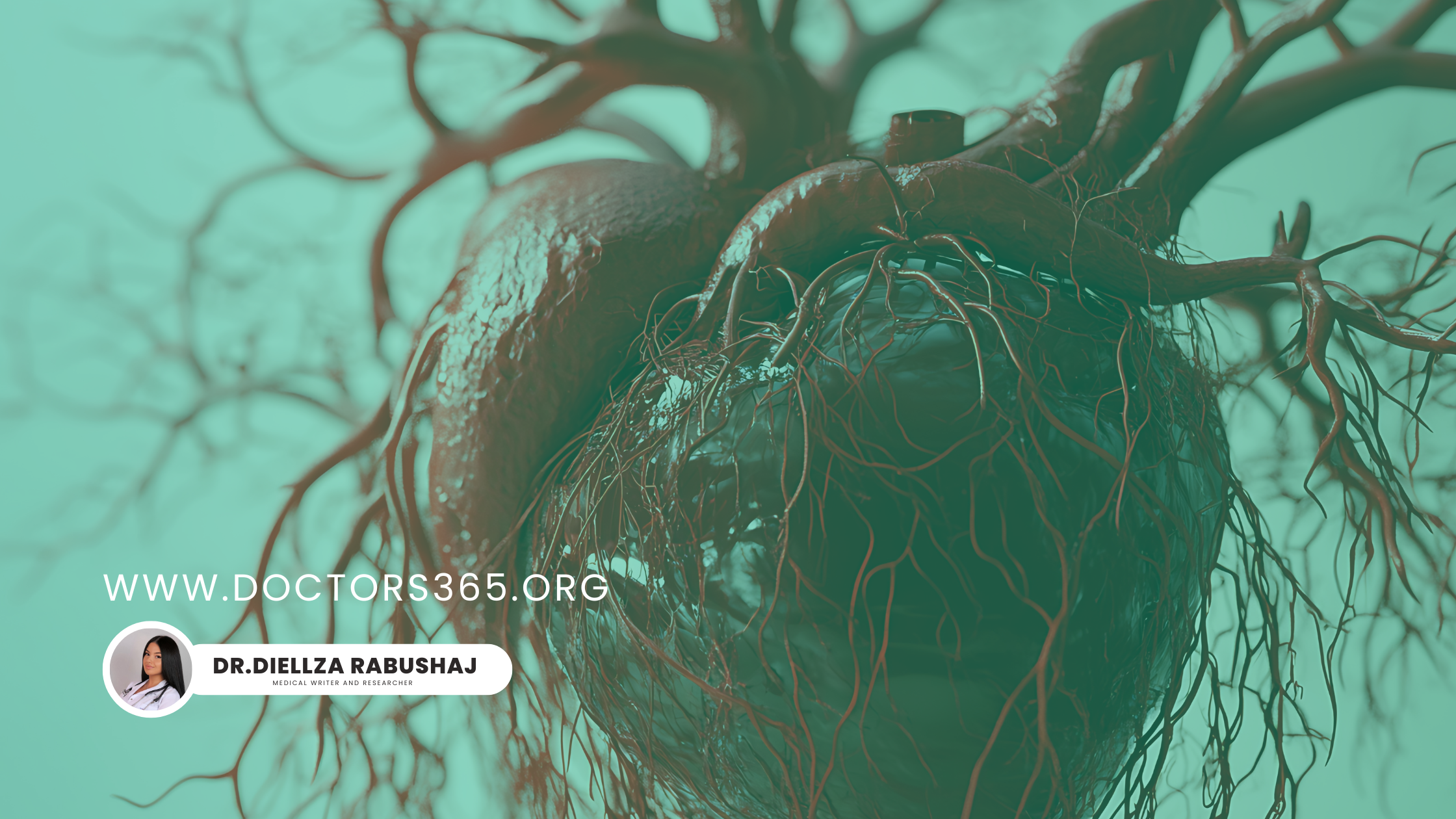 AI for Detecting Coronary Artery Disease (CAD)