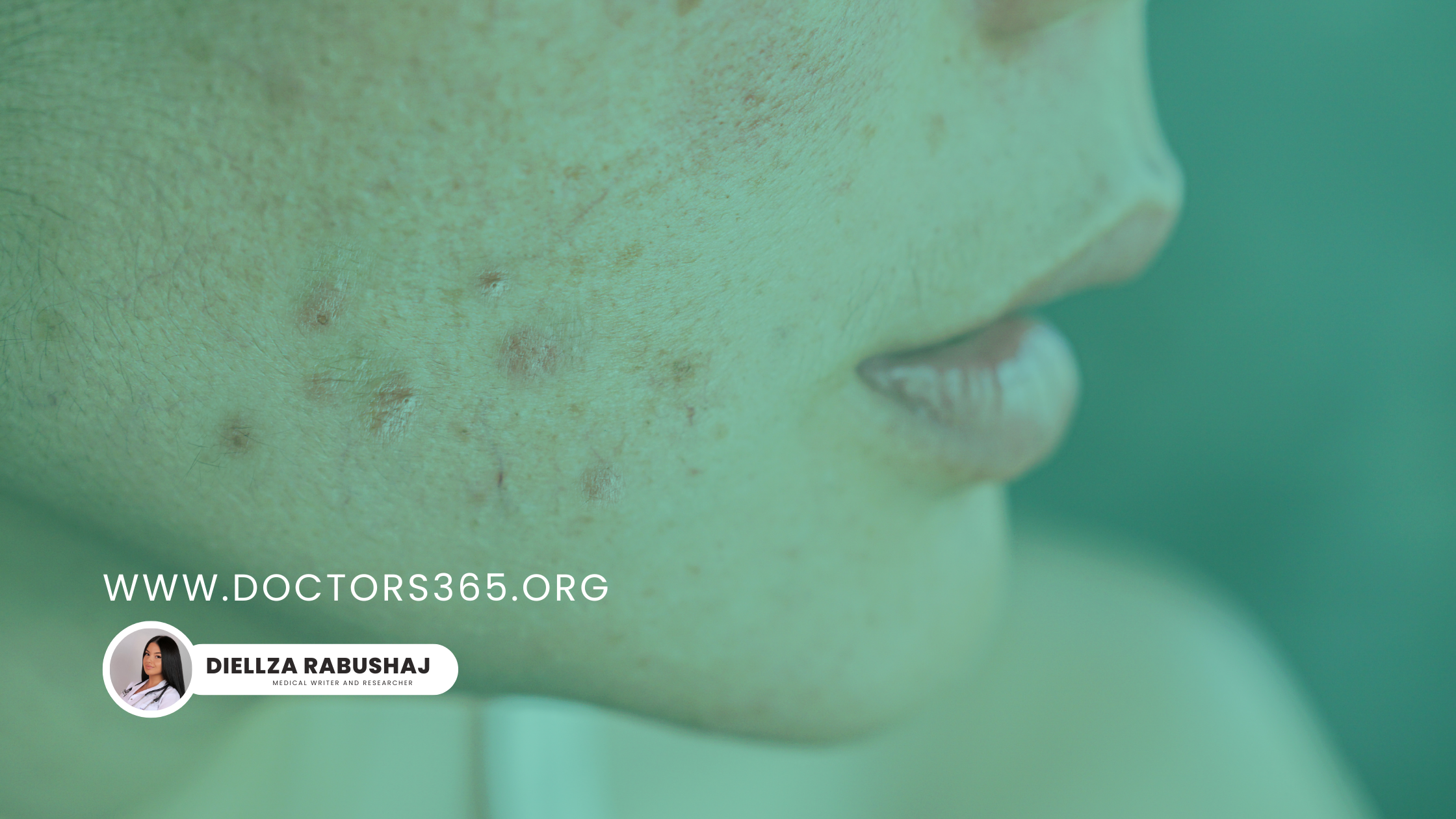 Clear Skin with Doctors365