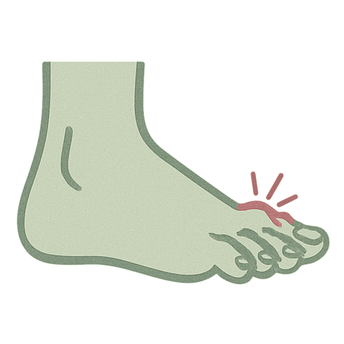 Hammer Toes Shoes