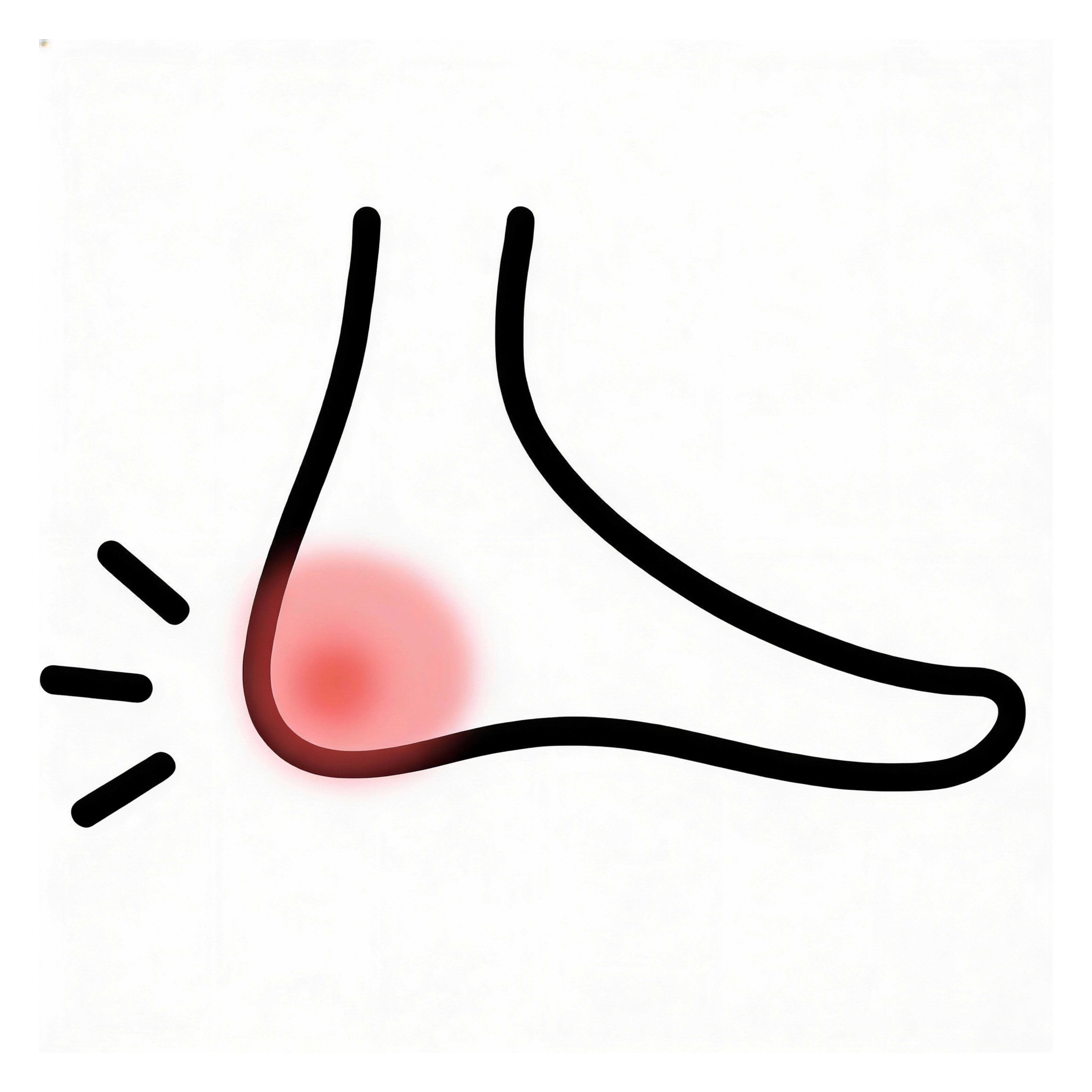 Plantarfasziitis