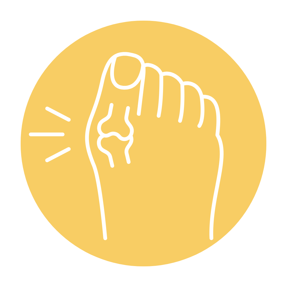 Prevention of Corns and Calluses
