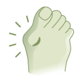 Hallux valgus