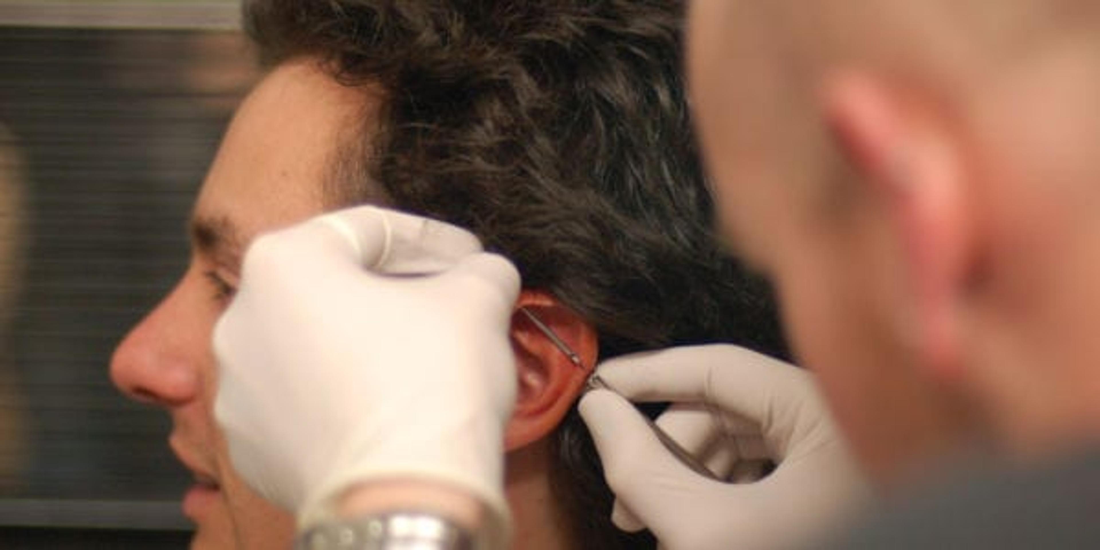 Cartilage piercing
