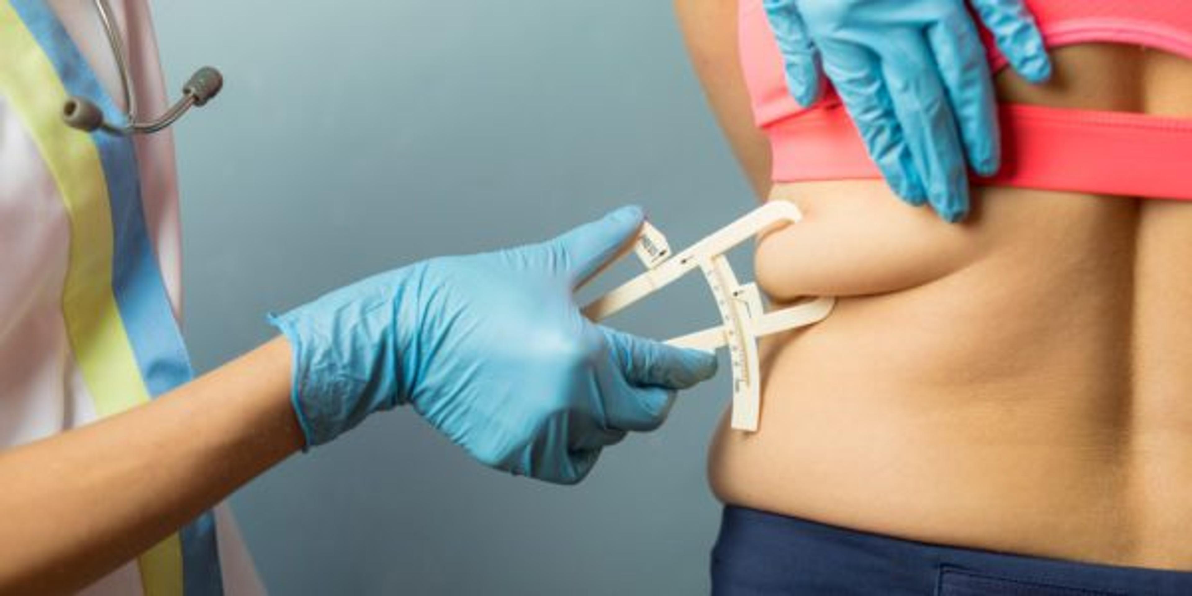 Doctor using body fat caliper