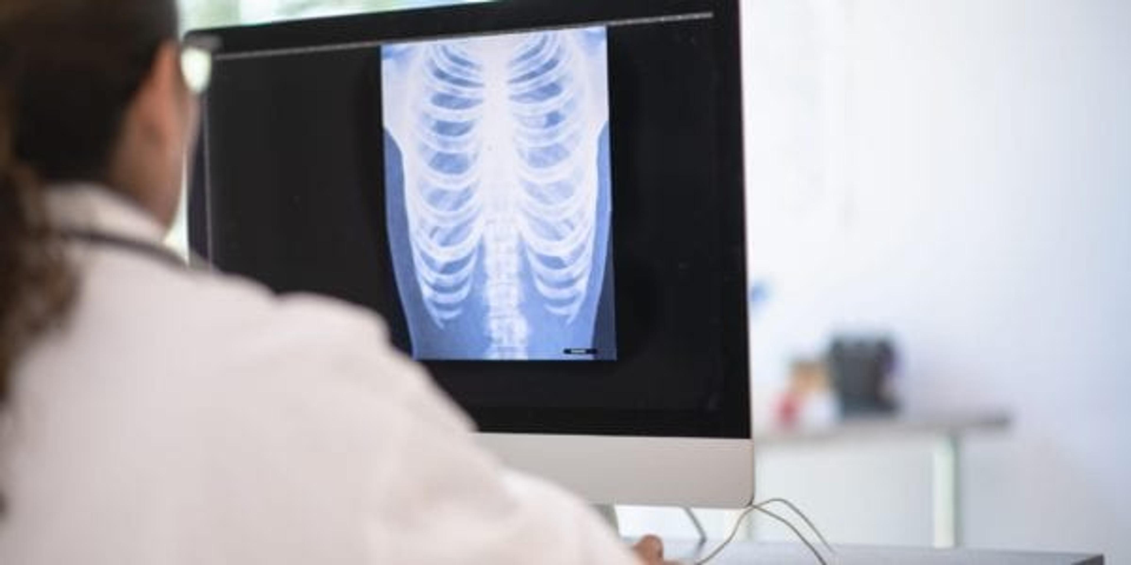 Doctor looking at an image of a lung.
