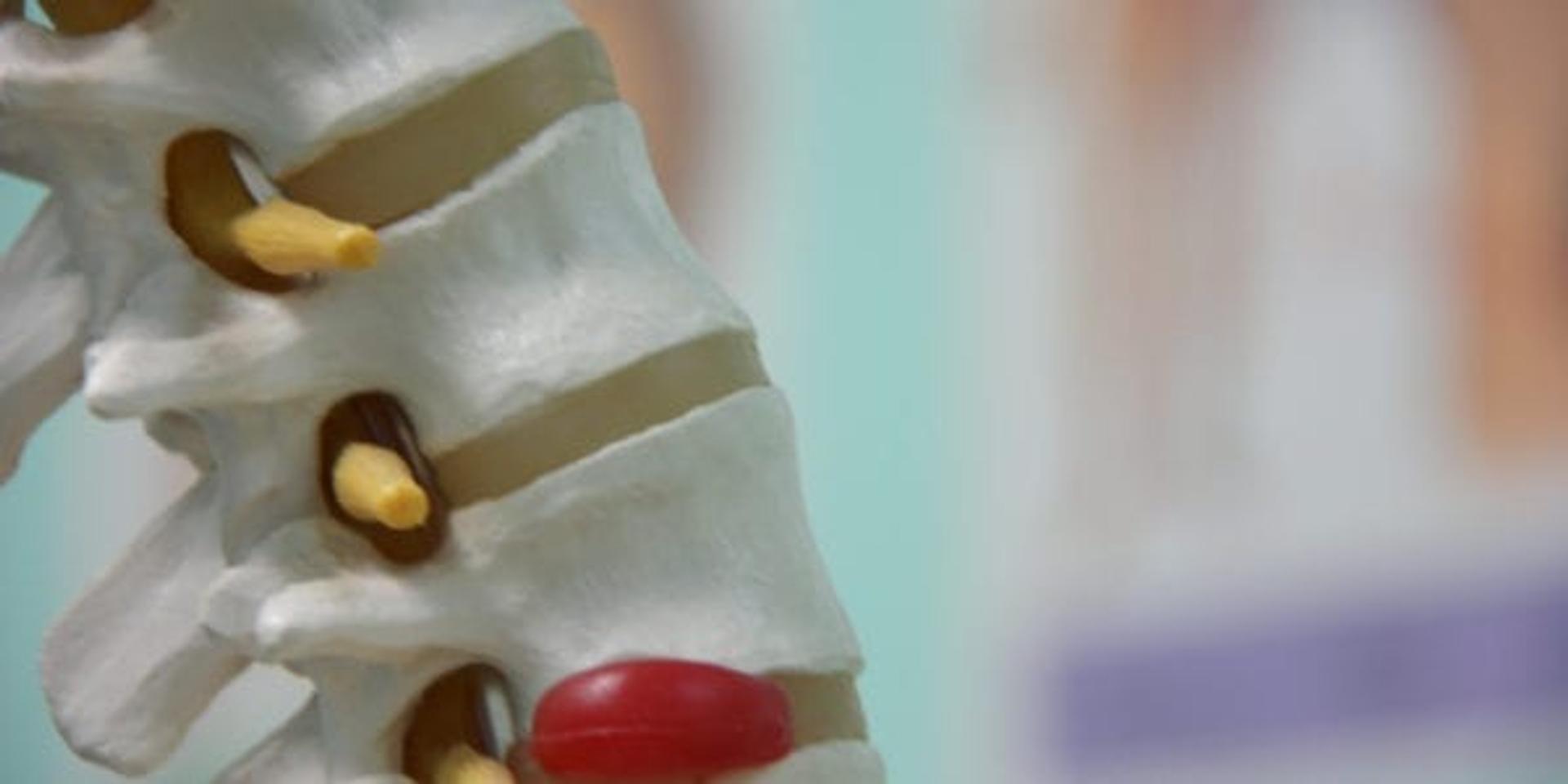 Five Exercises to Help Your Back Pain Go Away for Good