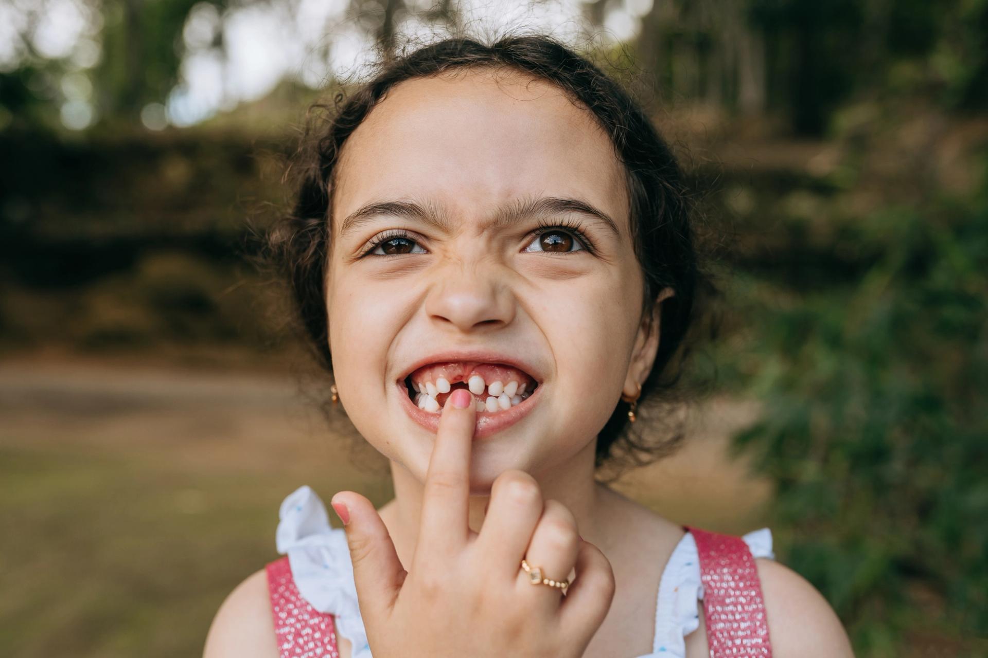 When Do Kids Start Losing Teeth  when-do-kids-start-losing-teeth