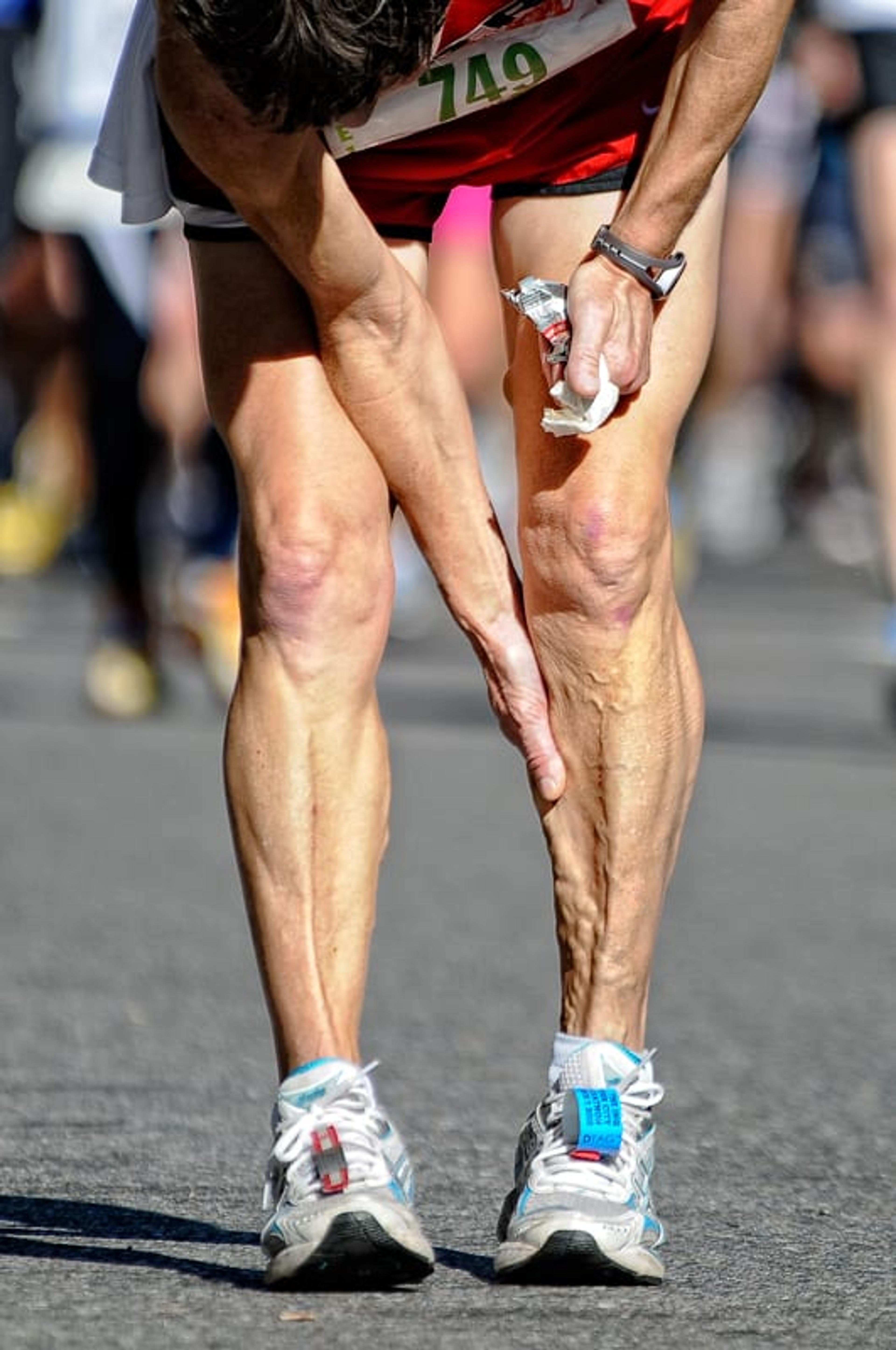 Судороги икроножных ног. Икроножная мышца. Икроножная мышца ноги. Ноги марафонцев.
