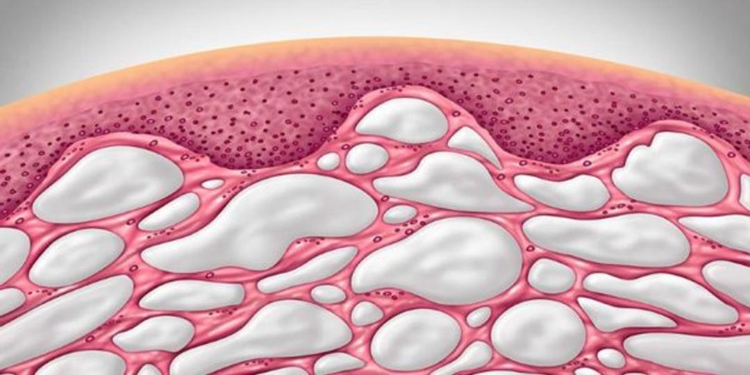 How to Care for Your Interstitium, Which May Be Your Newest Organ
