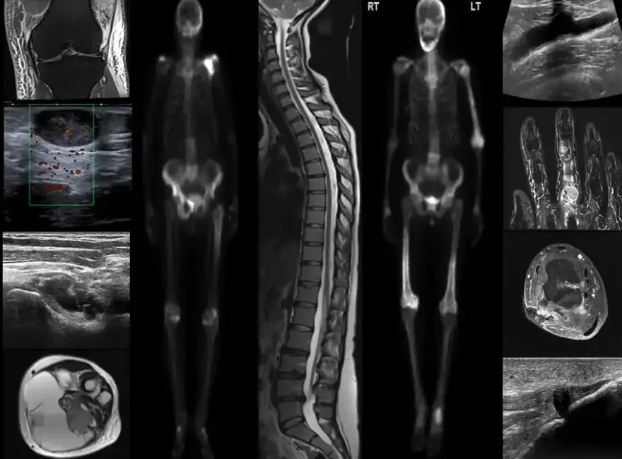 The BSSR - Image of a skeletal scan
