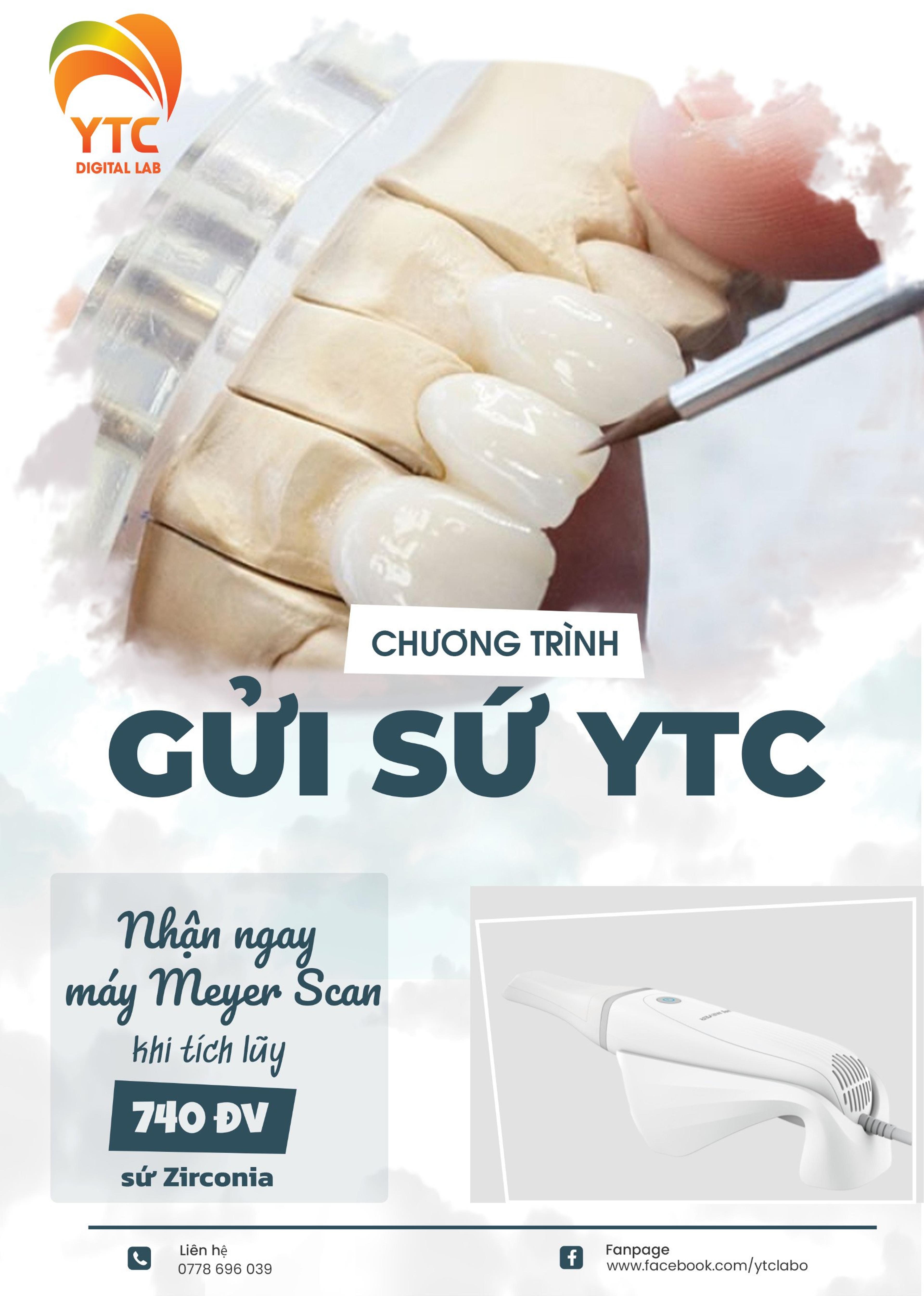 Nhận máy quét Meyer Scan khi tích lũy 740 đơn vị Sứ Zirconia