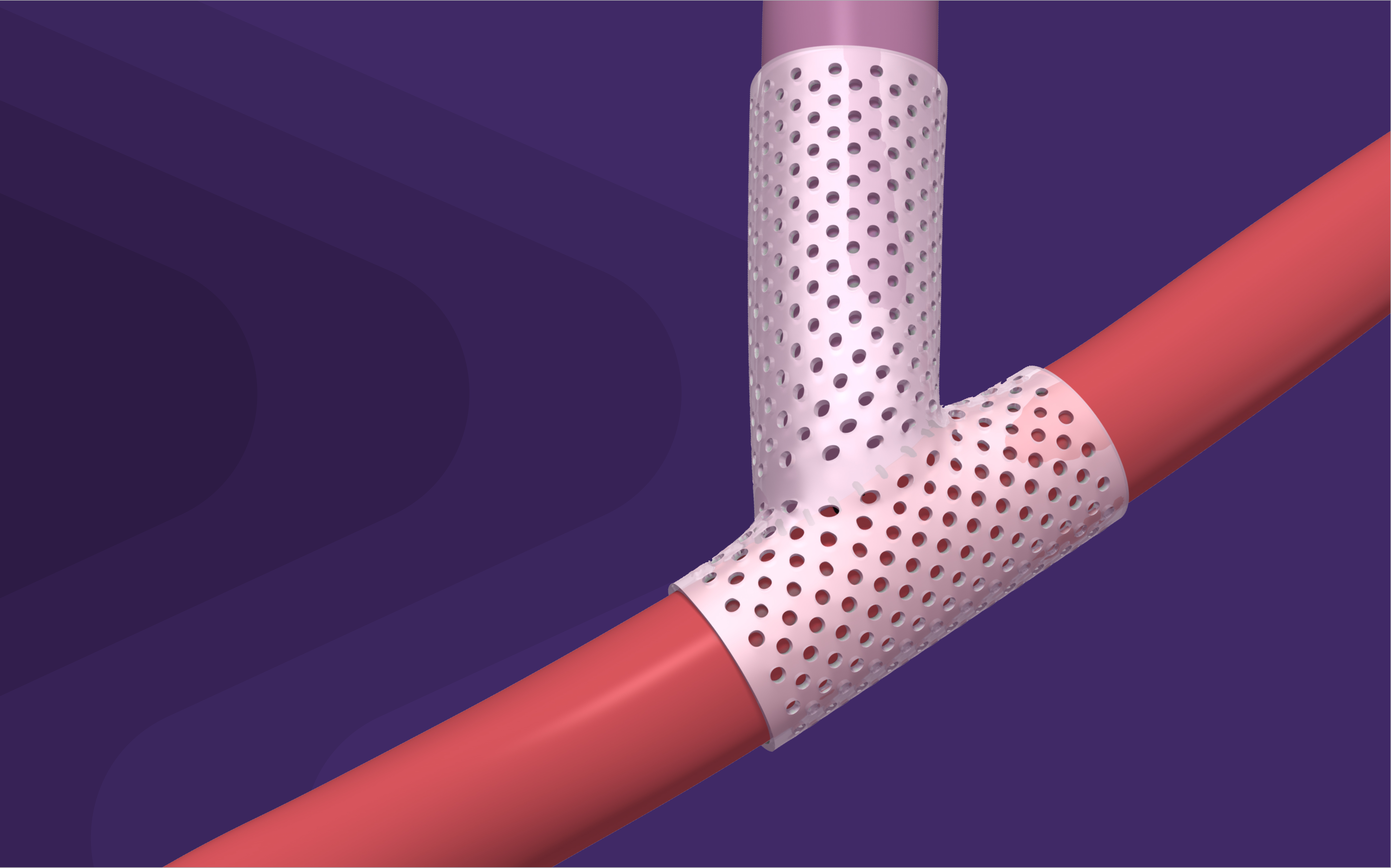 VenoStent Enrolls First Subjects in 200-Subject US Clinical Trial