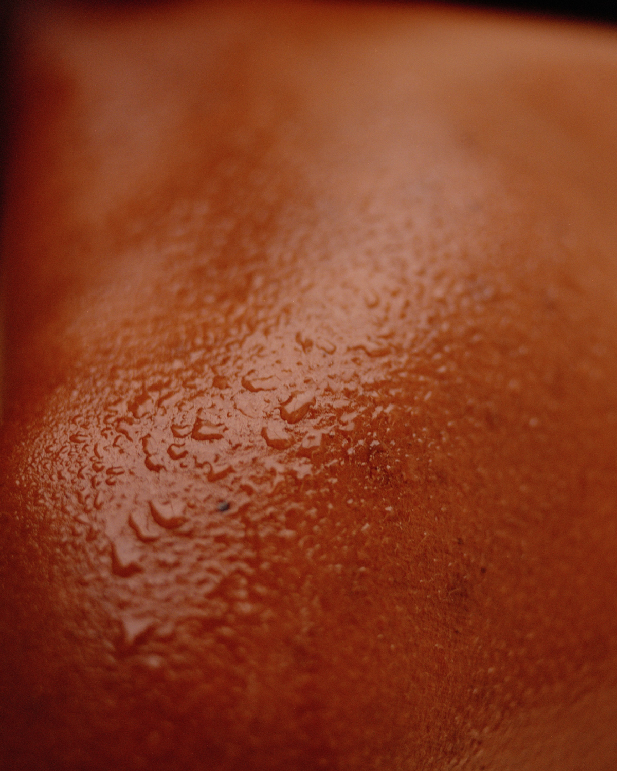 Close-up of reddish-brown skin with numerous water droplets.