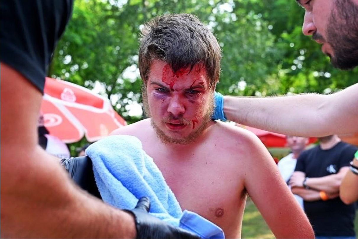 Erik Máša během jednoho ze svých Bare Knuckle zápasů.