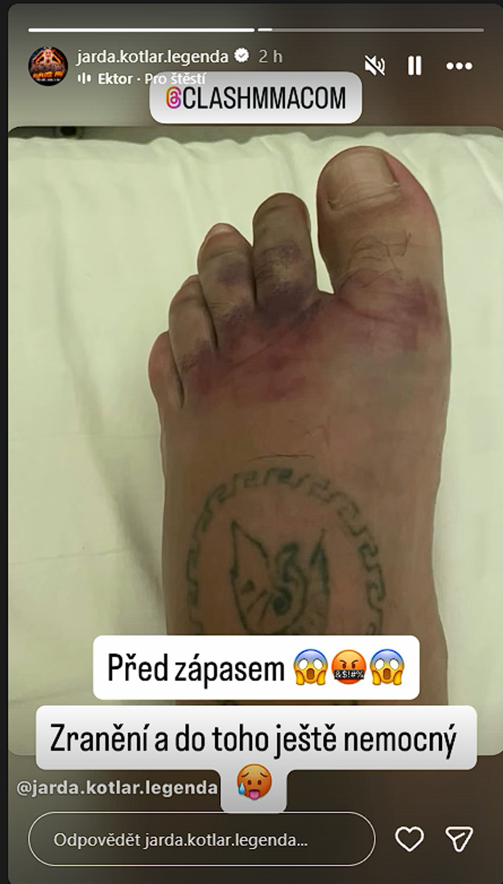 Instagram story Kotlár