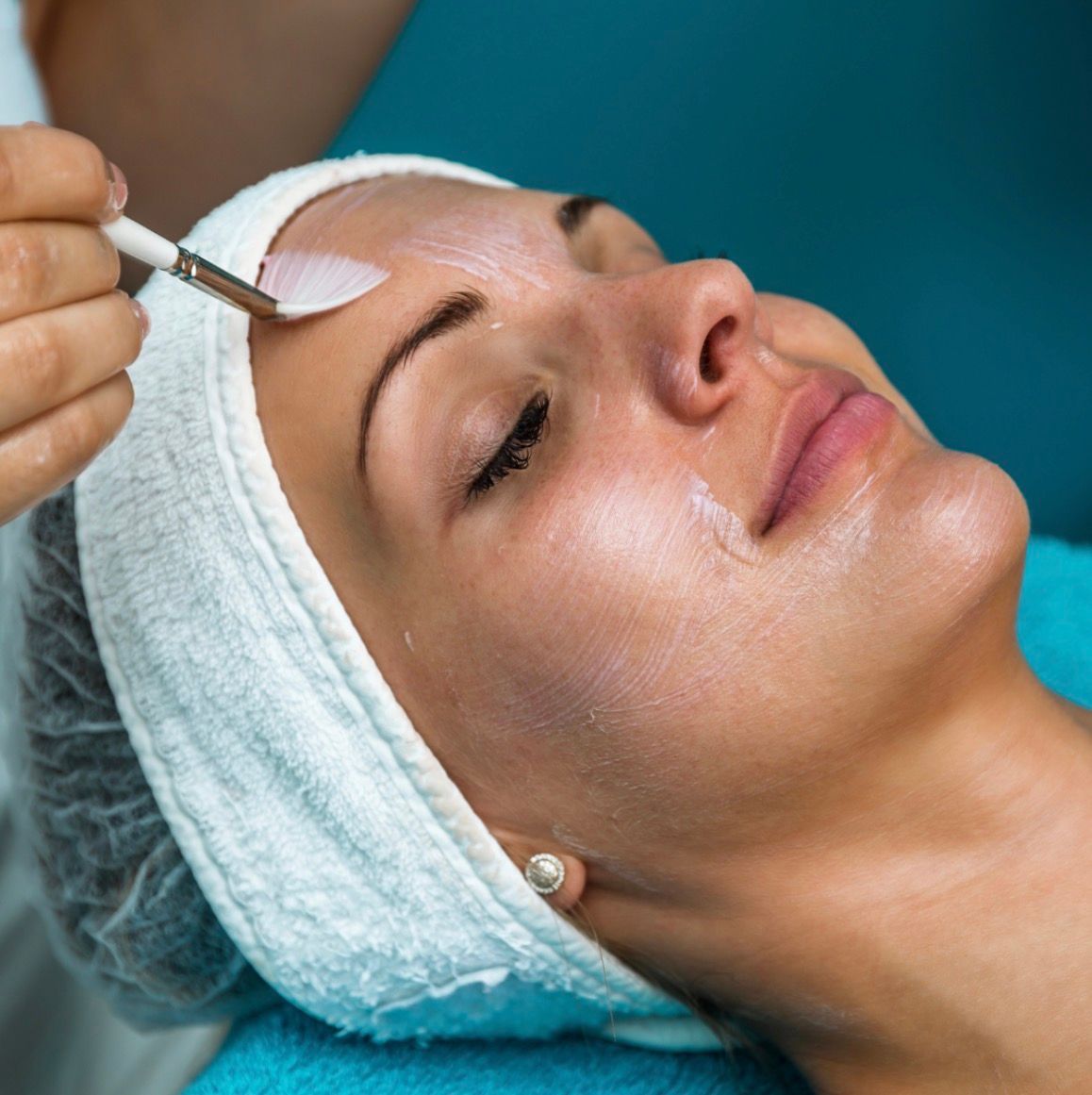 Chemical Peels treatment