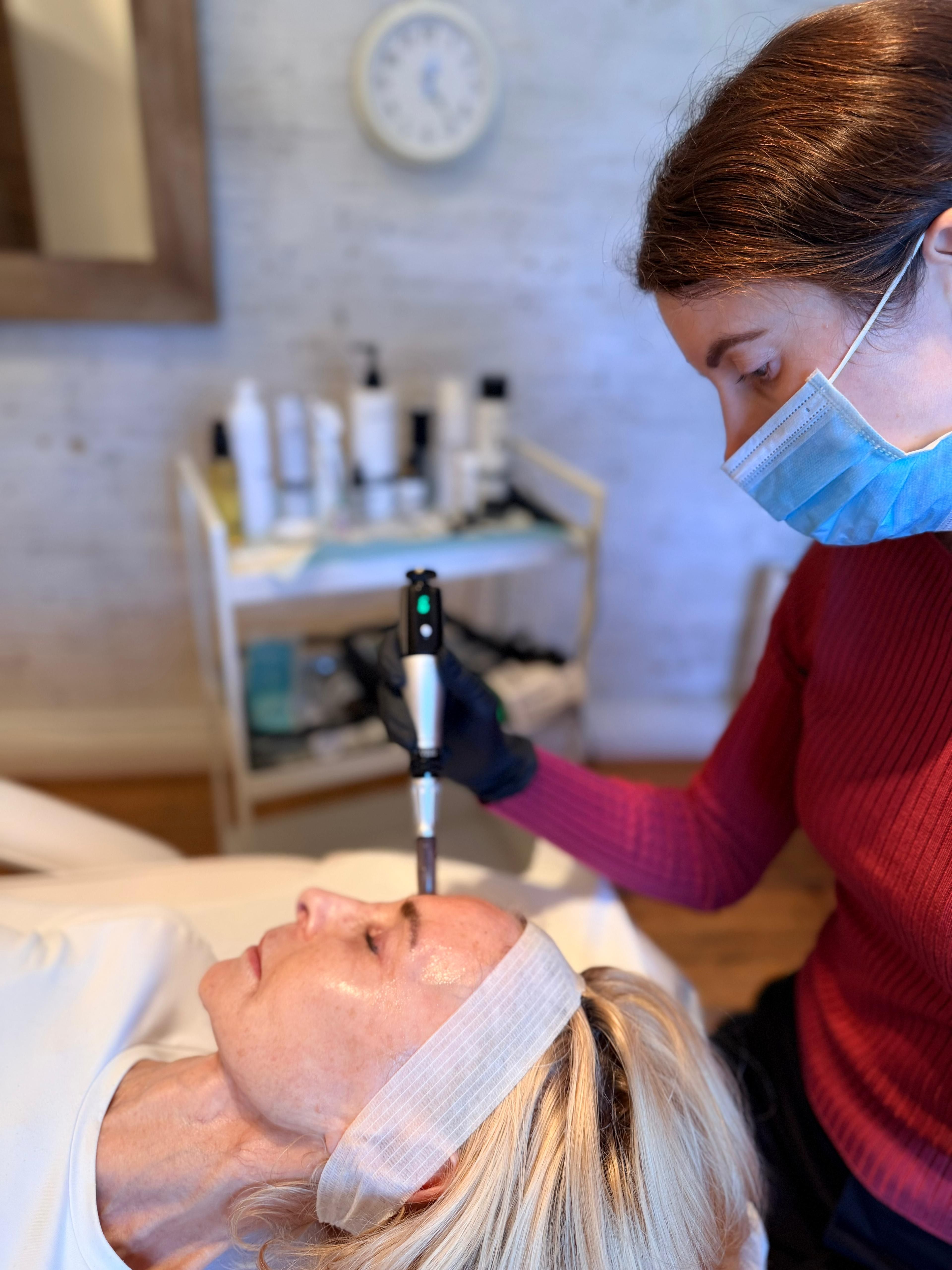 Microneedling treatment