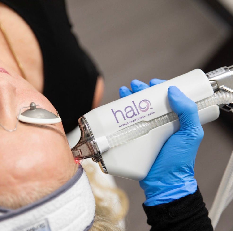 HALO® Laser treatment