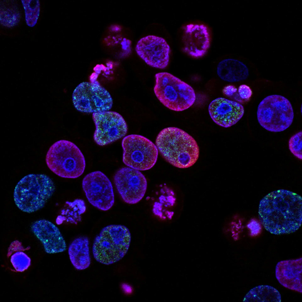 Volanteus Announce Exciting DKMS Blood cancer Partnership