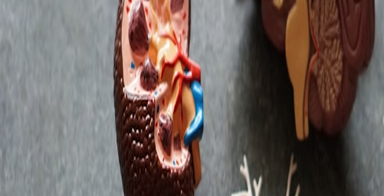 Urinary Tract Stones