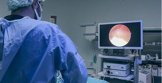 Laparoscopy