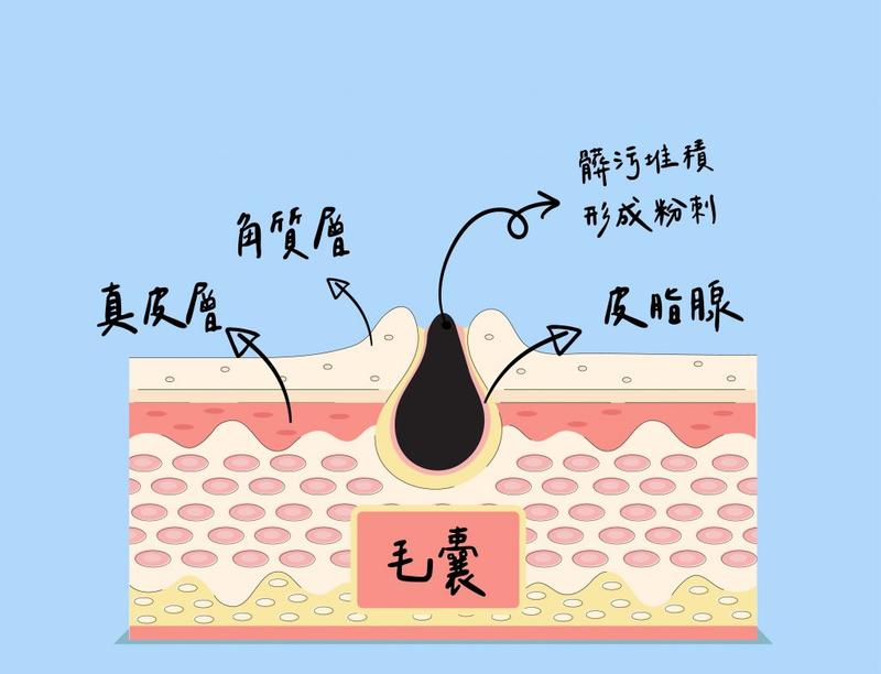 抗痘商品推薦排行榜TOP10【2026年最新版】
