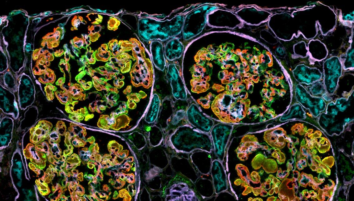 Spatial Proteomics for Clinical Research: A Platform Perspective — Blog