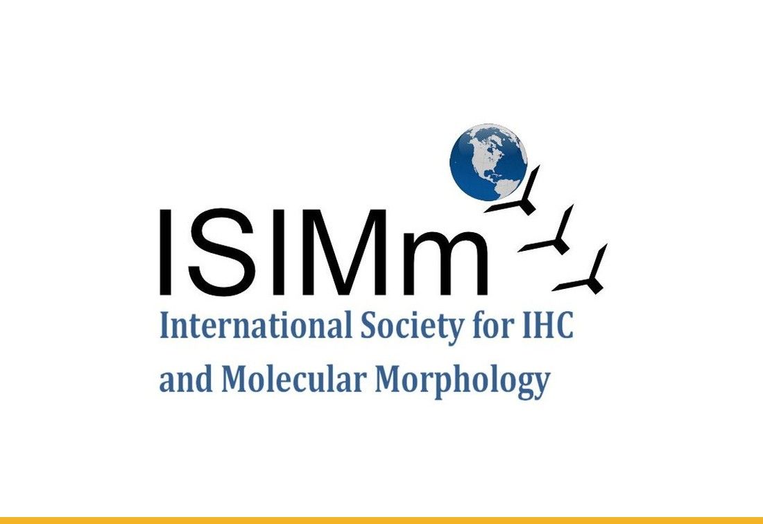 Quantitative Assays for TROP2 Measurement in Breast Cancer and Comparison to H-Score — Publication