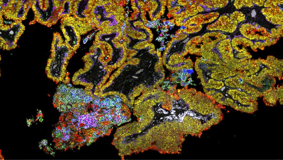 The 3 Biggest Challenges When Designing a Spatial Proteomic Panel — Blog