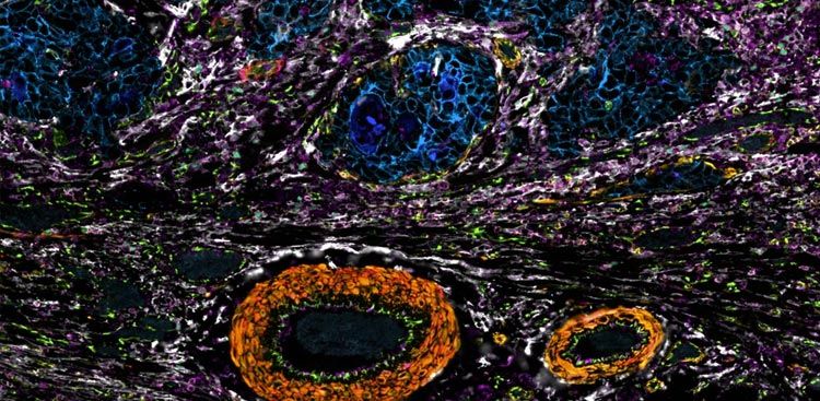 Understanding Multiplex Immunofluorescence: Choosing the Right Technology for Discovery, Biomarker Development, and Clinical Research — Blog
