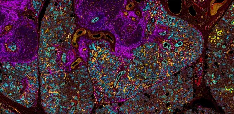 Optimizing spatial proteomics for discovery and translational research — Blog