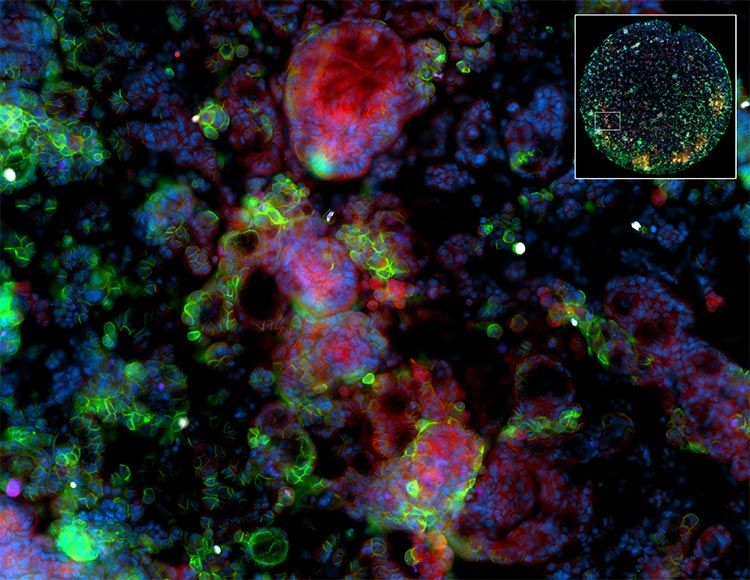 Multiplex IF tissue imaging