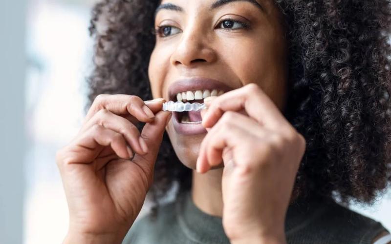 How Does Invisalign Work: 7 Things To Know