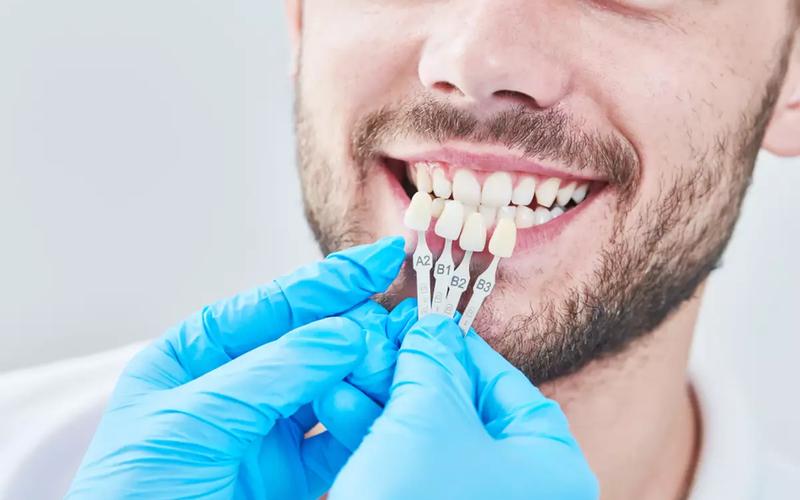 Restorative Dentistry: Restoring Your Smile with Modern Techniques