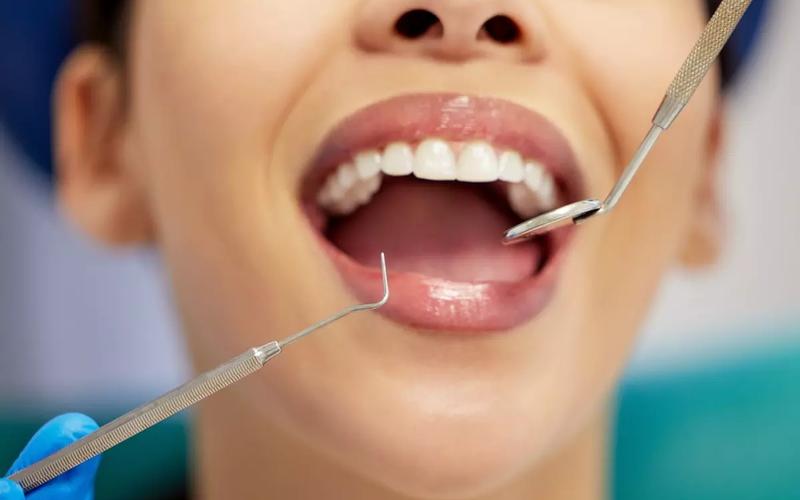 What to Expect During a Dental Cleaning