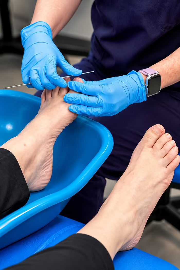 Fungal nail treatment at Active Step, Fareham