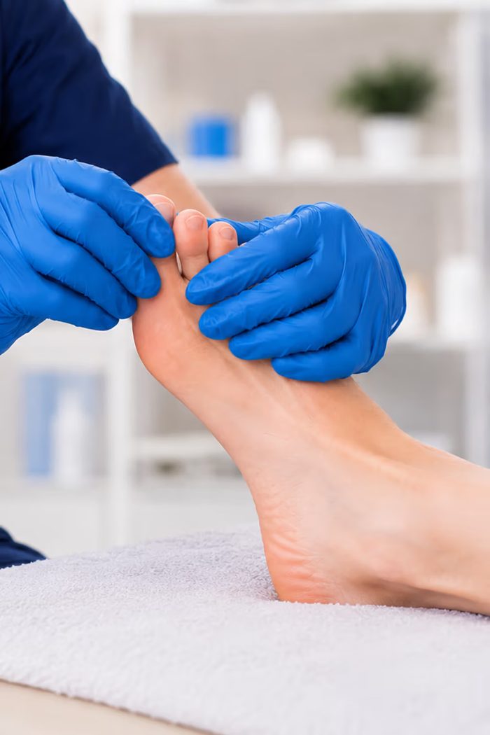 Diabetes foot health assessment at Active Step, Fareham