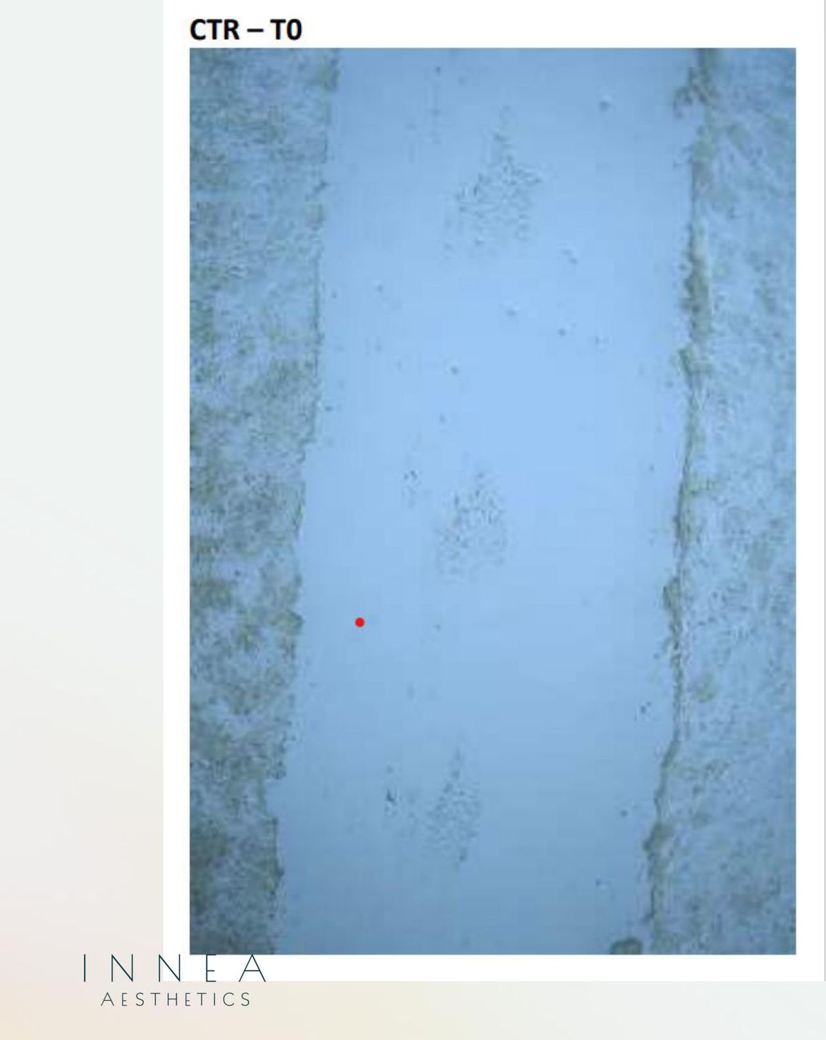Control cell-culture scratch test at the start (T0). The original microscope image and label are retained.