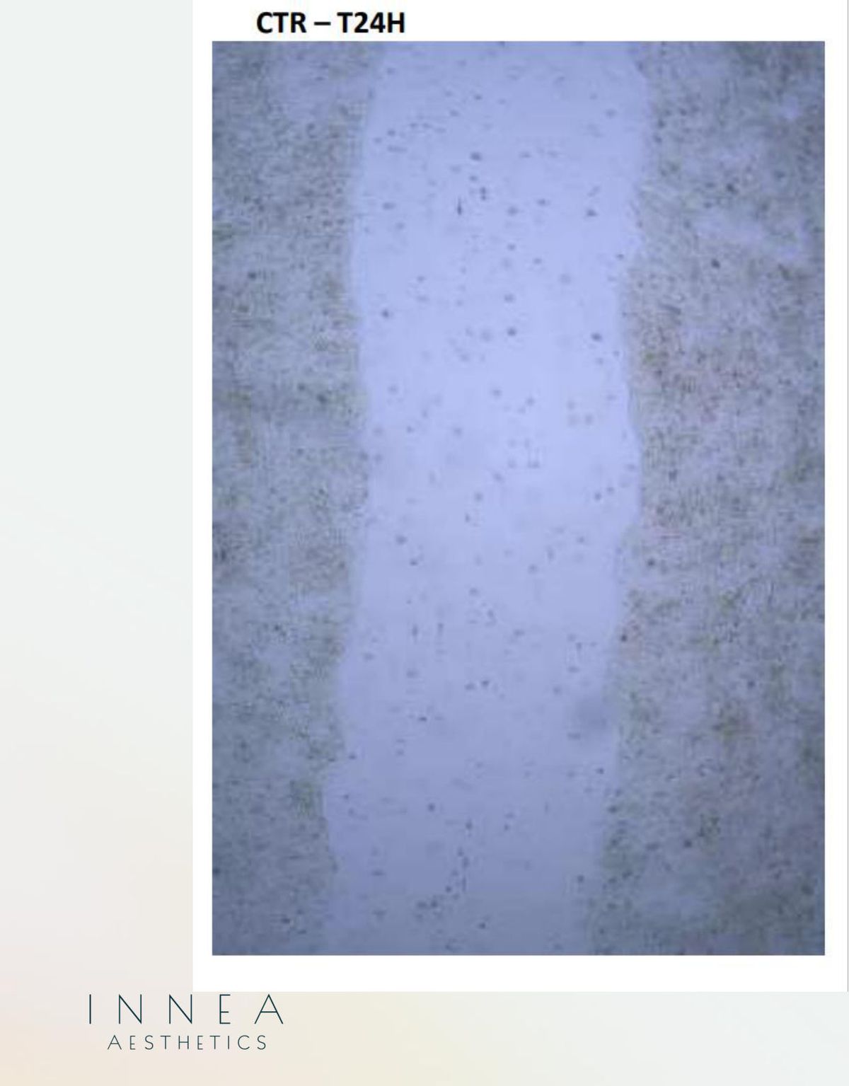 Control cell-culture scratch test at 24 hours (T24H). The original microscope image and label are retained.