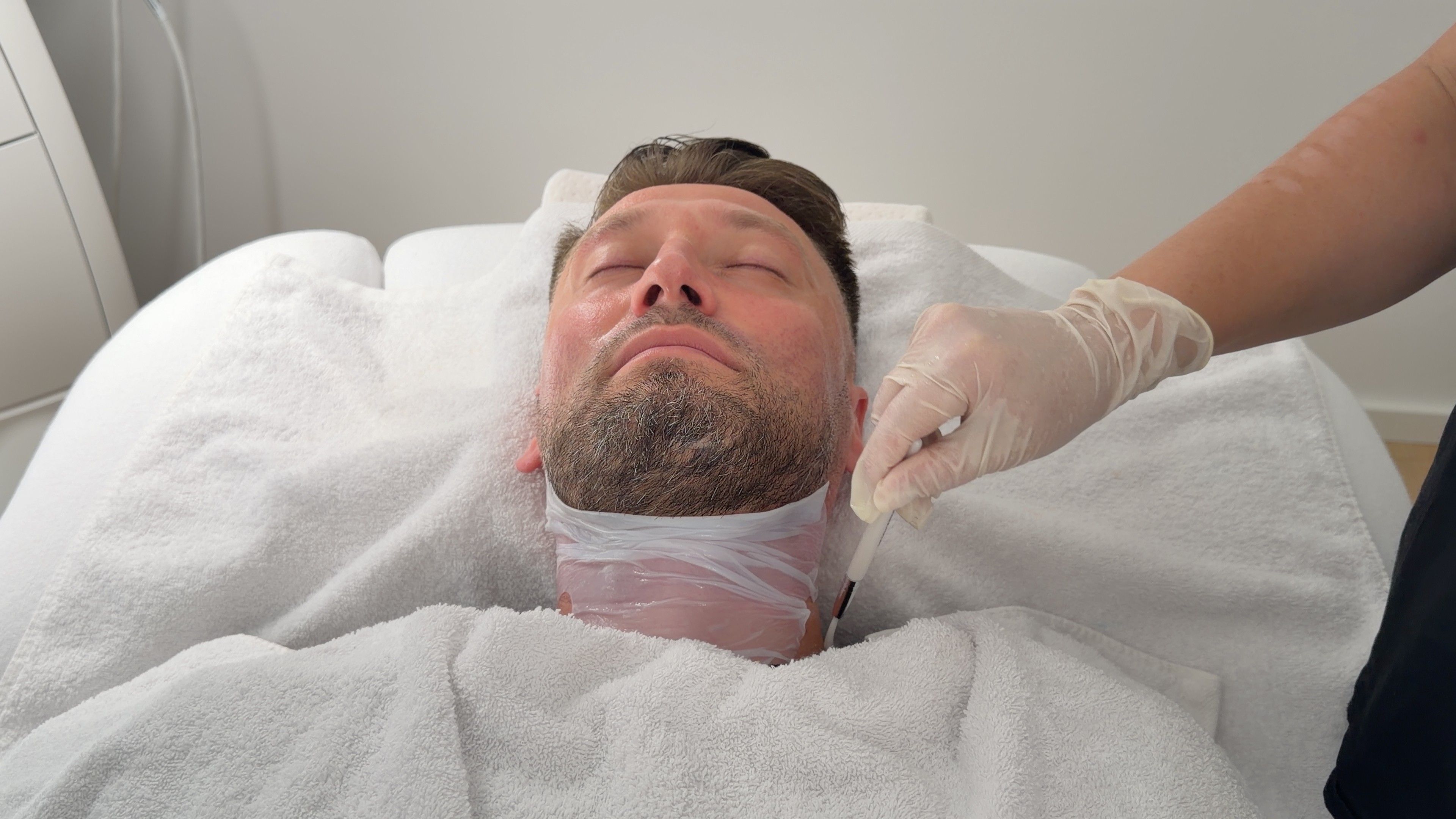 Laser-Haarentfernung im Bart- und Halsbereich bei einem Mann durch eine Behandlerin von MySilkSkin.