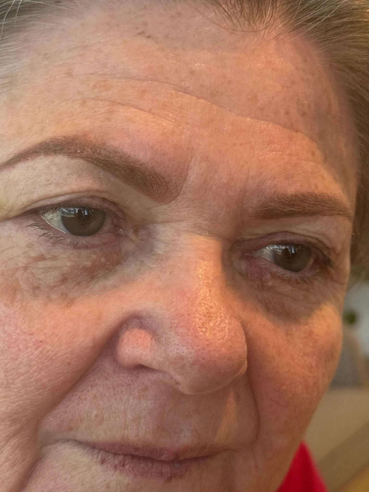 Nahaufnahme unregelmäßiger Pigmentierung der Haut, MySilkSkin Rheda-Wiedenbrück.