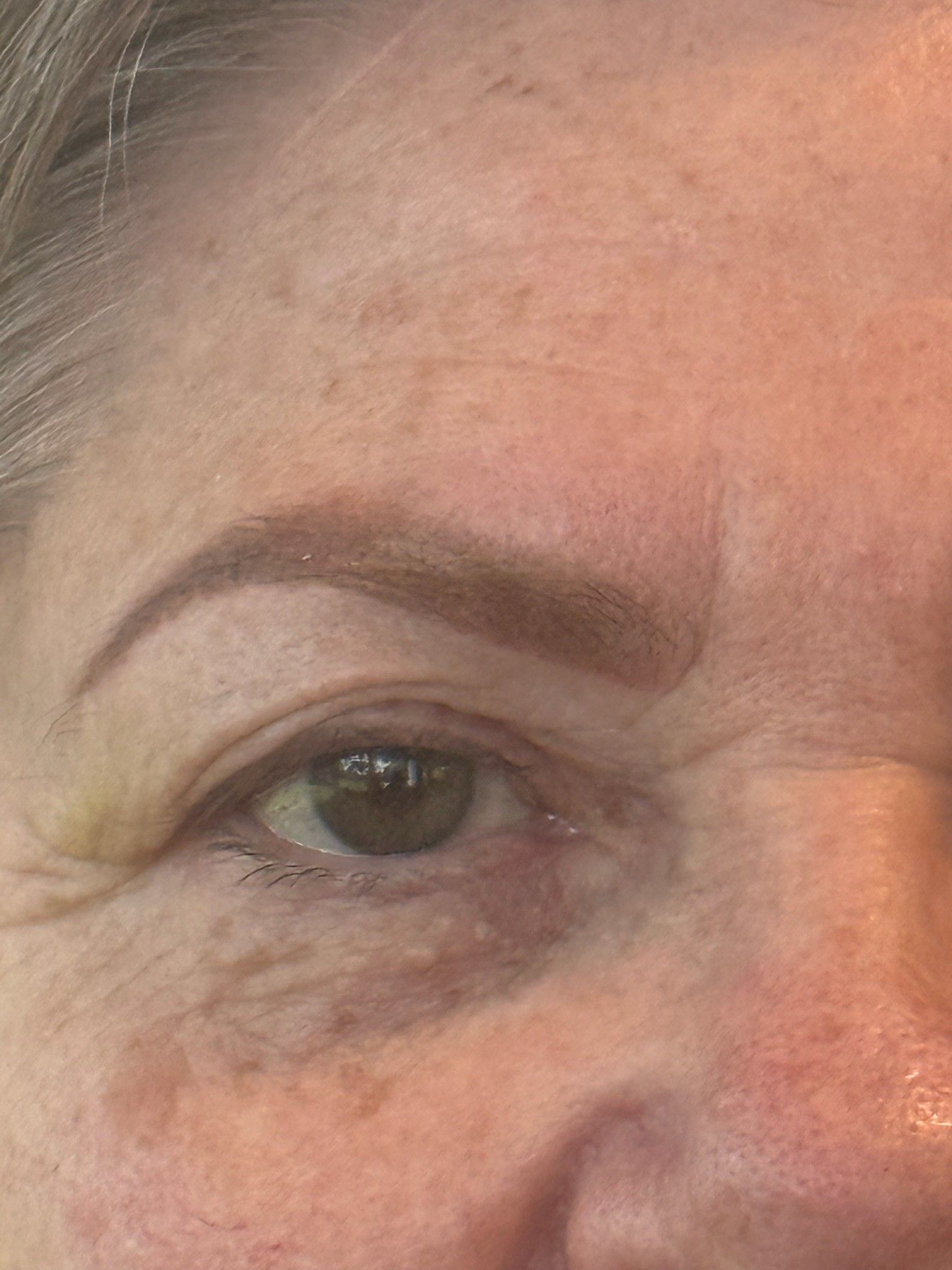 Detailaufnahme von Pigmentflecken auf der Haut bei MySilkSkin.