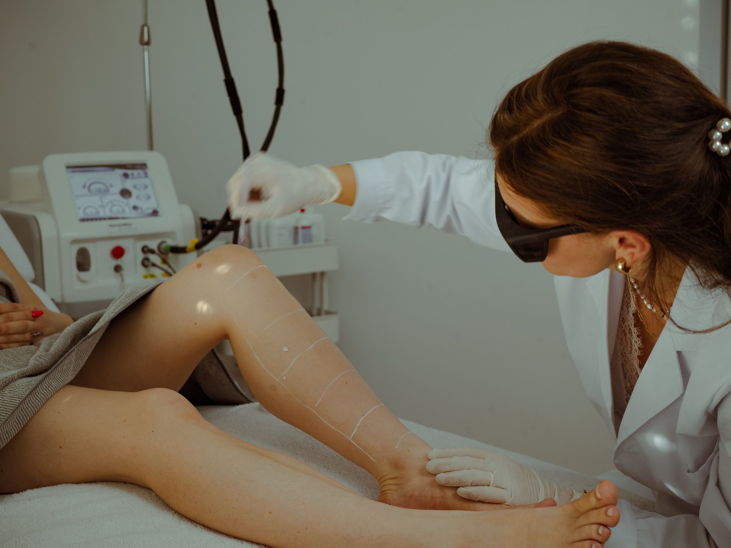 Behandlerin von MySilkSkin markiert die Behandlungszonen am Bein und stellt den Candela GentleMax für die Laser-Haarentfernung ein.