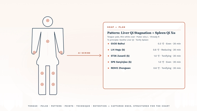 Best AI for acupuncturists documentation 2026 — a front-view body silhouette with acupuncture point markers at GV20, LI4 (bilateral), ST36 (bilateral), SP6 (bilateral), and REN12 is connected by a coral AI scribe arrow to a structured SOAP-Plan card showing pattern (Liver Qi Stagnation + Spleen Qi Xu), tongue and pulse findings, treatment principle, and itemised point + technique + retention rows. The illustration captures how a TCM-fit AI scribe converts a 20-minute encounter into a fully structured chart entry instead of a narrative paragraph.