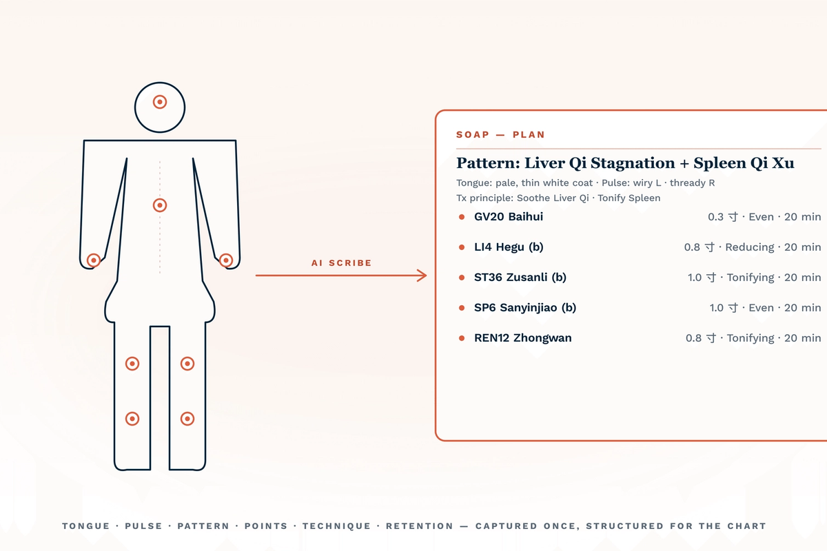 Best AI for acupuncturists documentation 2026 — a front-view body silhouette with acupuncture point markers at GV20, LI4 (bilateral), ST36 (bilateral), SP6 (bilateral), and REN12 is connected by a coral AI scribe arrow to a structured SOAP-Plan card showing pattern (Liver Qi Stagnation + Spleen Qi Xu), tongue and pulse findings, treatment principle, and itemised point + technique + retention rows. The illustration captures how a TCM-fit AI scribe converts a 20-minute encounter into a fully structured chart entry instead of a narrative paragraph.