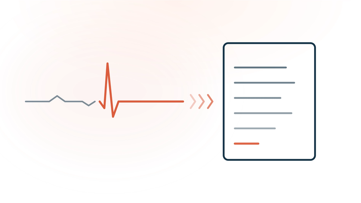 AI medical scribes in the ER — an EKG pulse trace with one coral spike flowing into a clinical note card, representing high-acuity emergency care meeting ambient AI documentation.