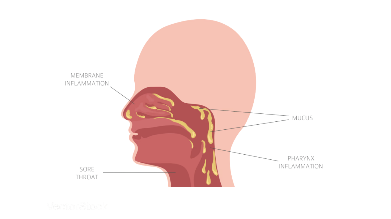 Postnasal drip throat evaluation and care in Hyderabad
